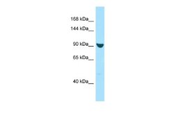 RANBP17 Rabbit anti-Human, Polyclonal, Novus Biologicals 0.1 mL | Buy Online | Novus Biologicals | Fisher Scientific